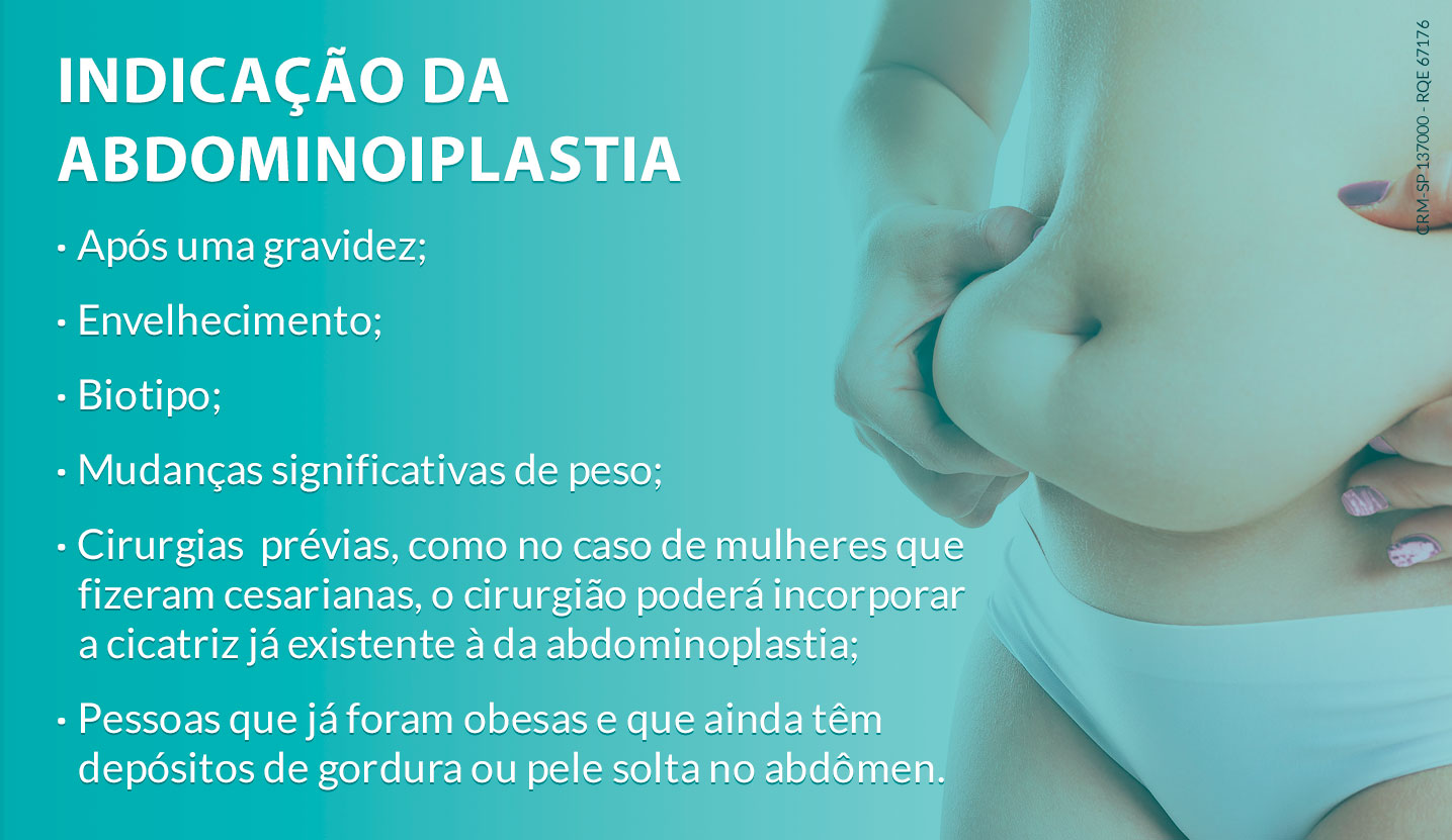 Indicação da abdominoplastia Abdominoplastia: tudo que você deve saber
